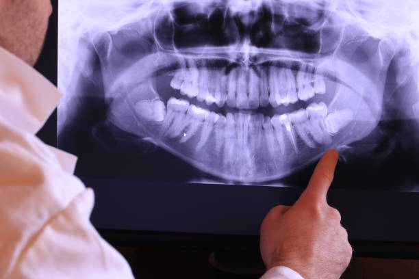 Best Emergency Treatment for Oral Infections in New Castle Northwest, PA