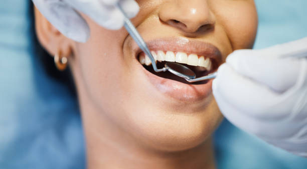 Best Emergency Wisdom Tooth Extraction in New Castle Northwest, PA